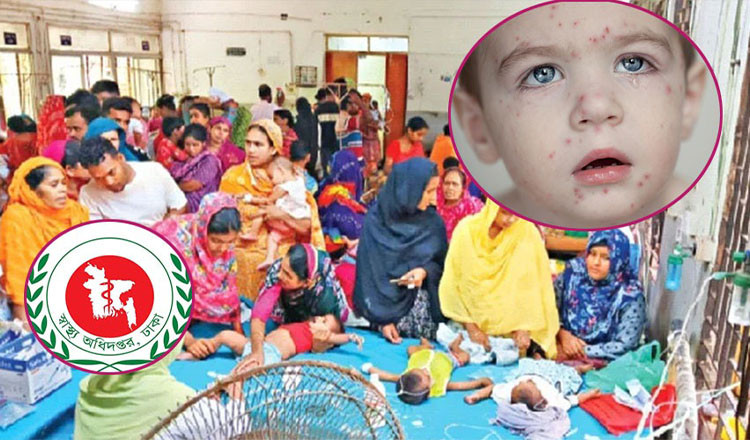 হাম আক্রান্ত শিশুদের চিকিৎসায় নিয়োজিত ডাক্তার-নার্সদের ঈদের ছুটি বাতিল